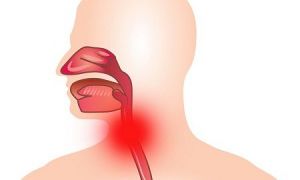 Воспаление гортани: причины, диагностика и лечение