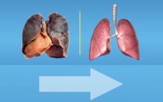 Легкие после избавления от курения