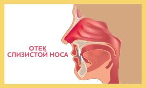 Чем вызван отек слизистой носа? Симптомы недуга